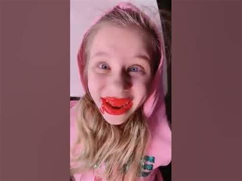 на приеме у зубного врача / страхи детства / тикто / лайки / вк клипы ...