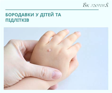 Бородавки у дітей та підлітків - Вік здоров’я
