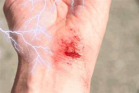 Исследователи утверждают, что электричество может ускорить заживление ...