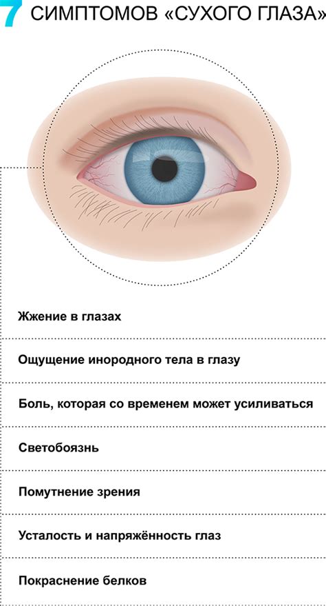 Сухой глаз. симптомы синдрома сухого глаза. причины сухости в глазах ...