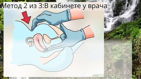 Как определить симптомы выкидыша - YouTube