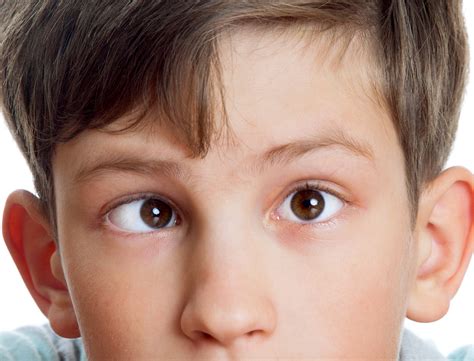 strabismus paphos eye  laser clinic