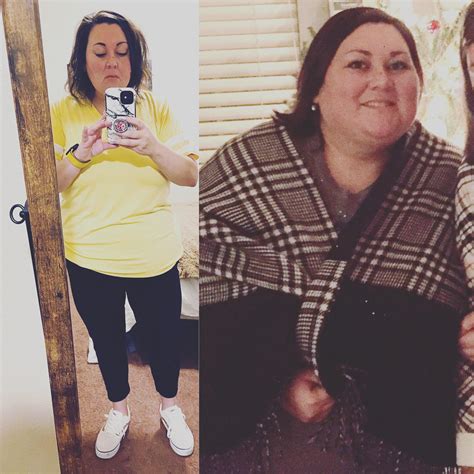 Slow and steady surgery Jan 14 2021… down 70lbs 🥰 : r/gastricsleeve