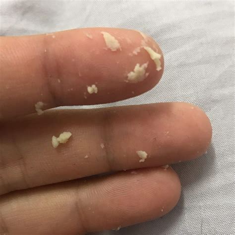 Seid tagen jucken im intim berreich, eben als ich mit meiner hand da ...