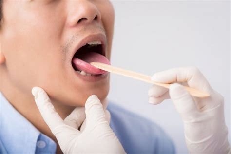 Нужна ли операция по удалению миндалин | MedAboutMe