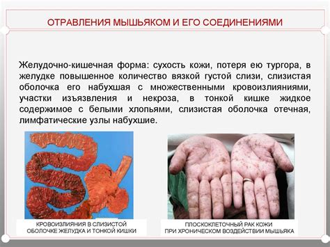 Судебно-медицинская токсикология. Повреждения от действия отравляющих ...