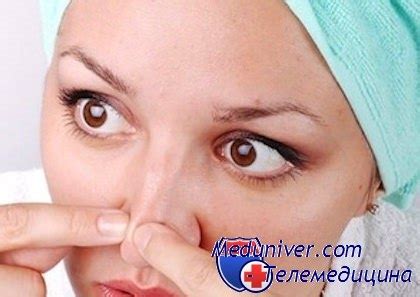 Домашние методы избавления от черных точек на лице и профилактика их ...