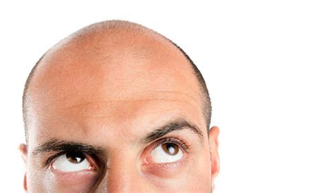 144.500+ Bald Person Fotografías de stock, fotos e imágenes libres de ...