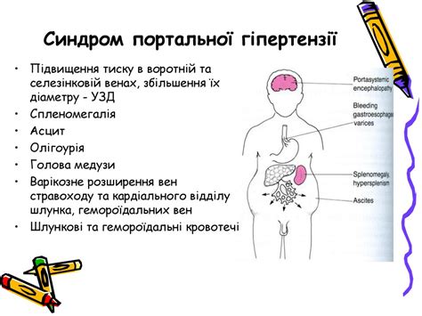 Діагностика патології гепато-біліарної системи - презентация онлайн