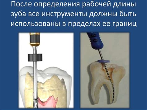 Цели и этапы эндодонтического лечения - презентация онлайн