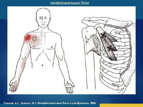 Боль Основные принципы лечения боли Реабилитация пациентов с