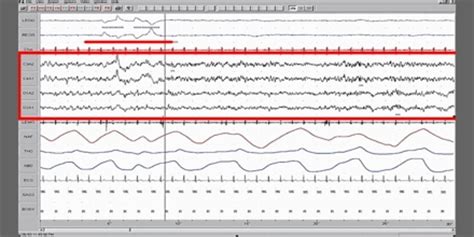 Electrooculography - Assignment Point