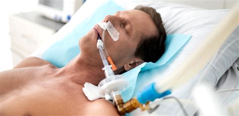 Ventilação Mecanica Invasiva - O acesso na Ventilação Mecânica Invasiva - Faça Fisioterapia