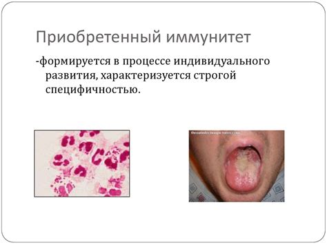 Иммунитет и его виды - презентация онлайн
