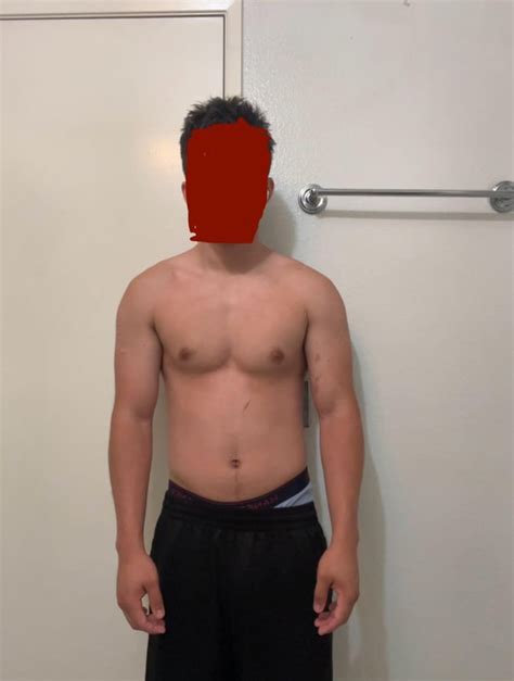 do i have narrow clavicles? : r/bodybuildingpics