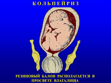 Кесарево сечение в акушерской практике - презентация онлайн