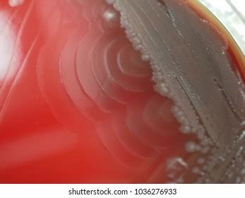 2+ Hundred Proteus Mirabilis Royalty-Free Images, Stock Photos ...