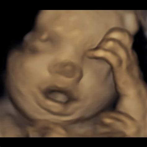 Ultrasound Image Gallery Near Me in Shrewsbury, NJ