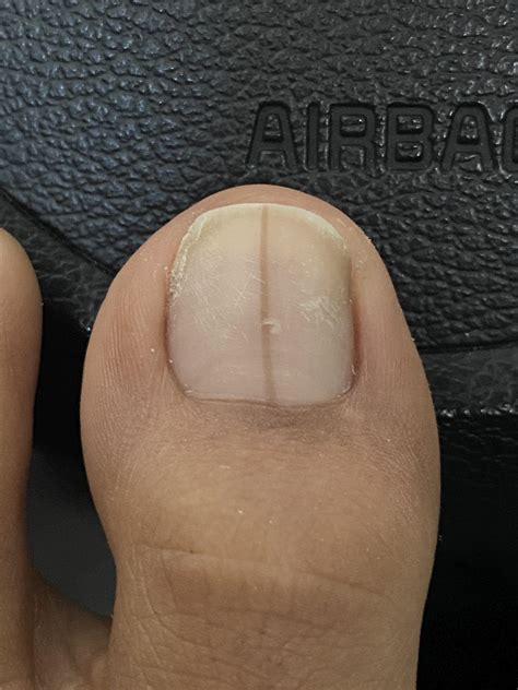 What Is The Secret White Toenails Polish Meaning That Everyone Is Talking About Online 1