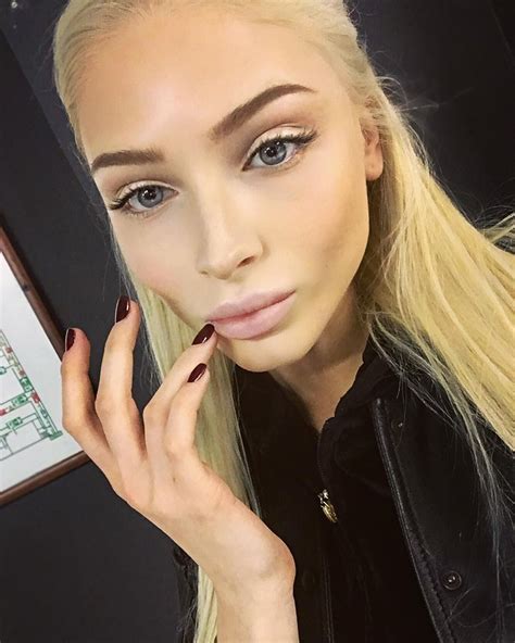 Алена Шишкова после пластики - 79 фото