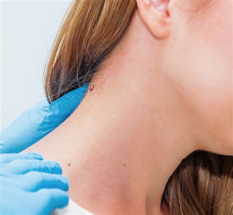Dermatologist in Johns Creek & North Atlanta | Board-Certified