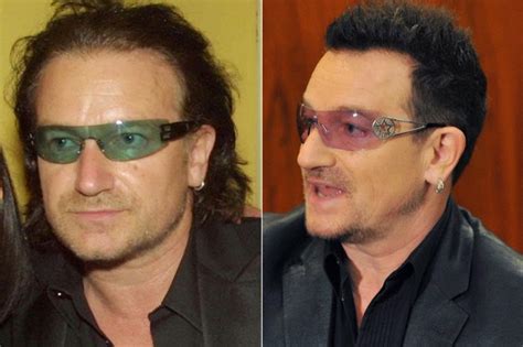 Chatter Busy: Bono Hair Transplant