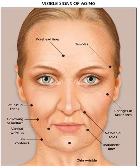 image result  anatomy face  cheek filler high cheekbone
