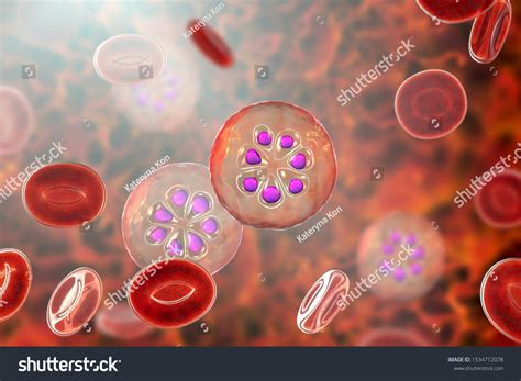 malaria schizont shutterstock