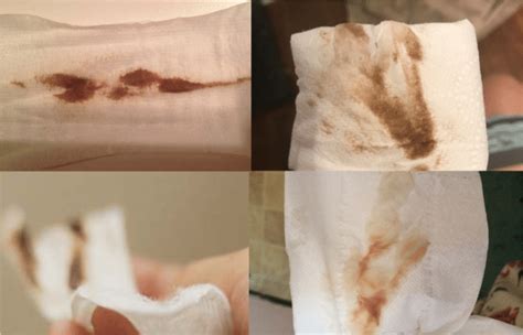Corrimento Marrom Mau Cheiro - Corrimento Marrom: o que é, como identificar e quando se preocupar