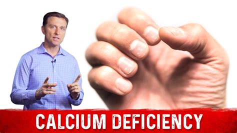 How To Check For Calcium Deficiency - Amountaffect17