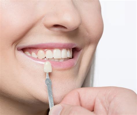 Dental Crowns vs Veneers : Which is Best for You?