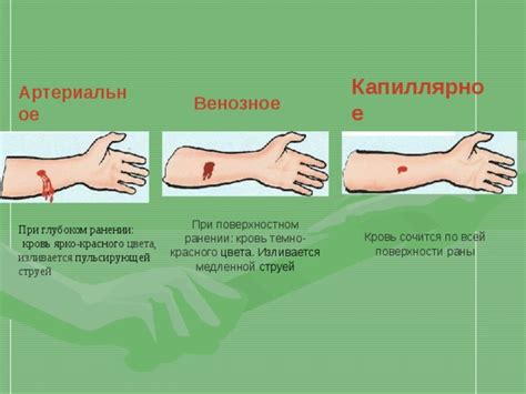 Кровотечения. Первая медицинская помощь