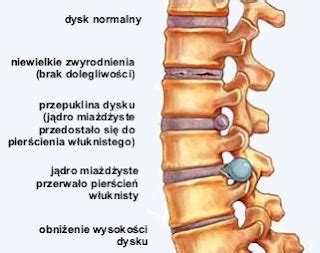 Ciekawostki: Czy można żyć bez... układu połączenia kości?