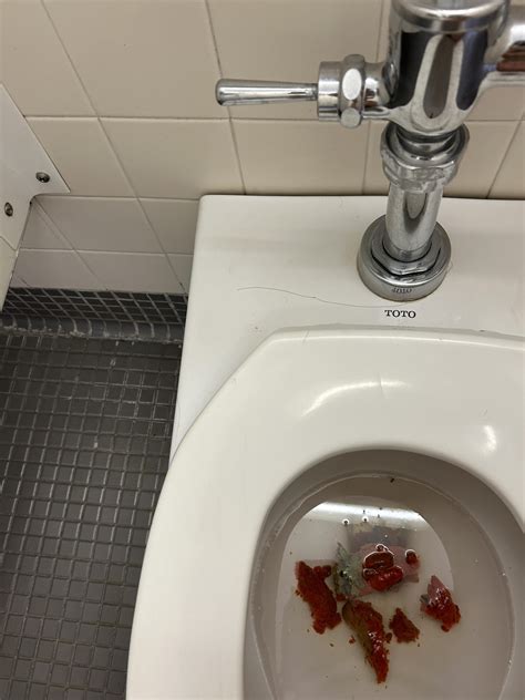 help! is this normal?! bloody stool : r/medical_advice