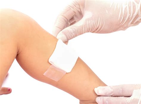 New smart bandages will be able to monitor the healing progress of ...