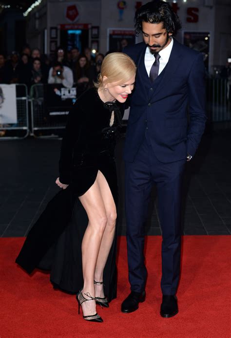 The Most Embarrassing Accidental Upskirt Ever
