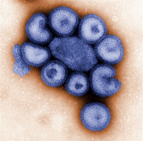 picture micrograph ultrastructural details influenza virus
