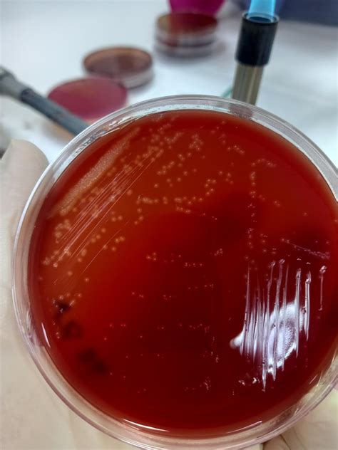 streptococcus anginosus group streptococcus anginosus wecpu