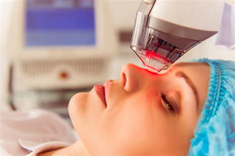 Laser Treatments for Rosacea: Frequently Asked Questions