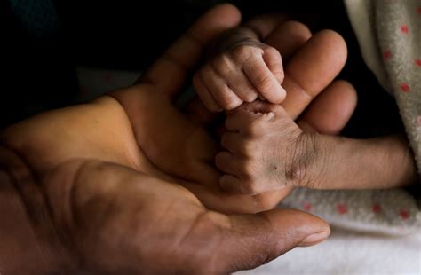 Trump's order will stop aid group feeding malnourished children in