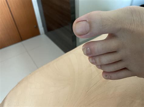 I am 17F. What’s causing my 2nd toe to be feeling more warm than the