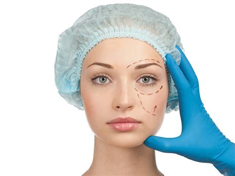 Bichectomy - Absolute Medical Tourism VIP CONCIERGE