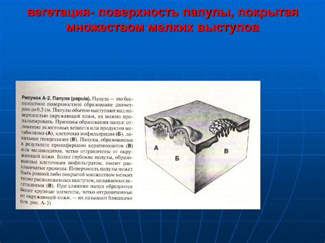 Первичные элементы кожи - online presentation