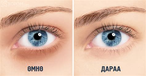 Нүдэн доор үүсэн хар хүрээг арилгах 10 арга