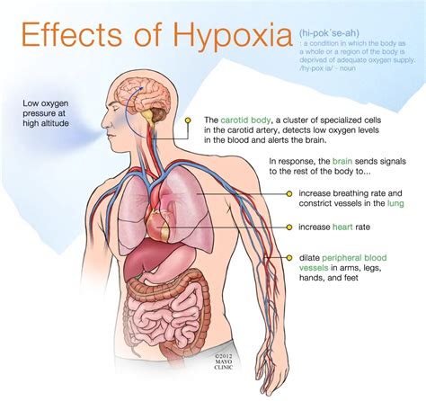 What are the signs and symptoms of hypoxia? – Free CPR Training