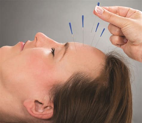 acupuncture offers  treatments  improved results   practice