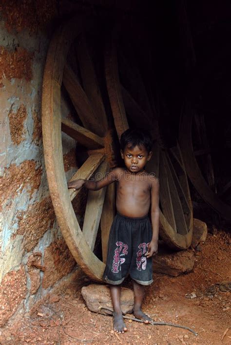 Malnourished Children in India Editorial Photo - Image of heritage ...