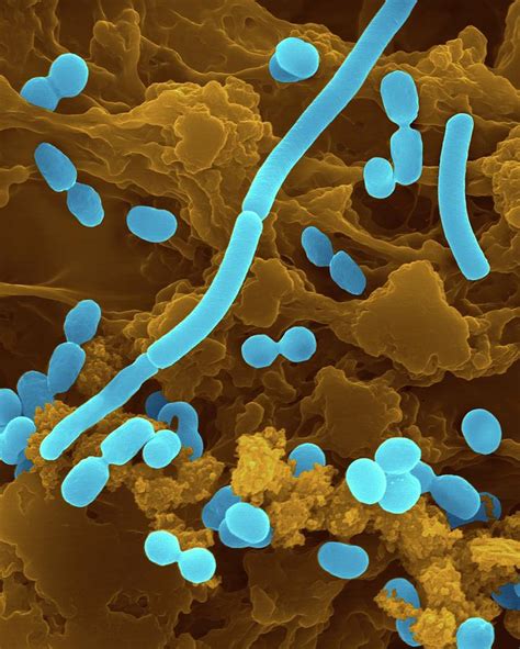 acinetobacter sp  science photo library