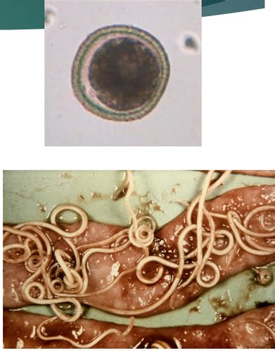 Dog & Cat Nematodes Flashcards | Quizlet