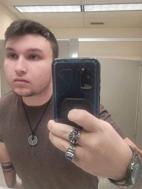 Eyes are sunkin in and baggy. Also look discolored like purple. I look